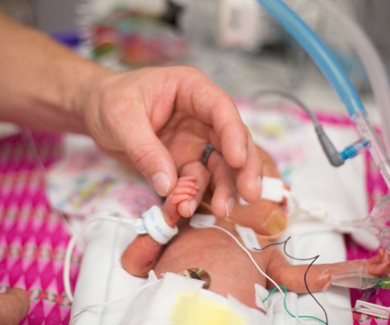 Αντιμετώπιση προβλημάτων πρόωρων νεογνών